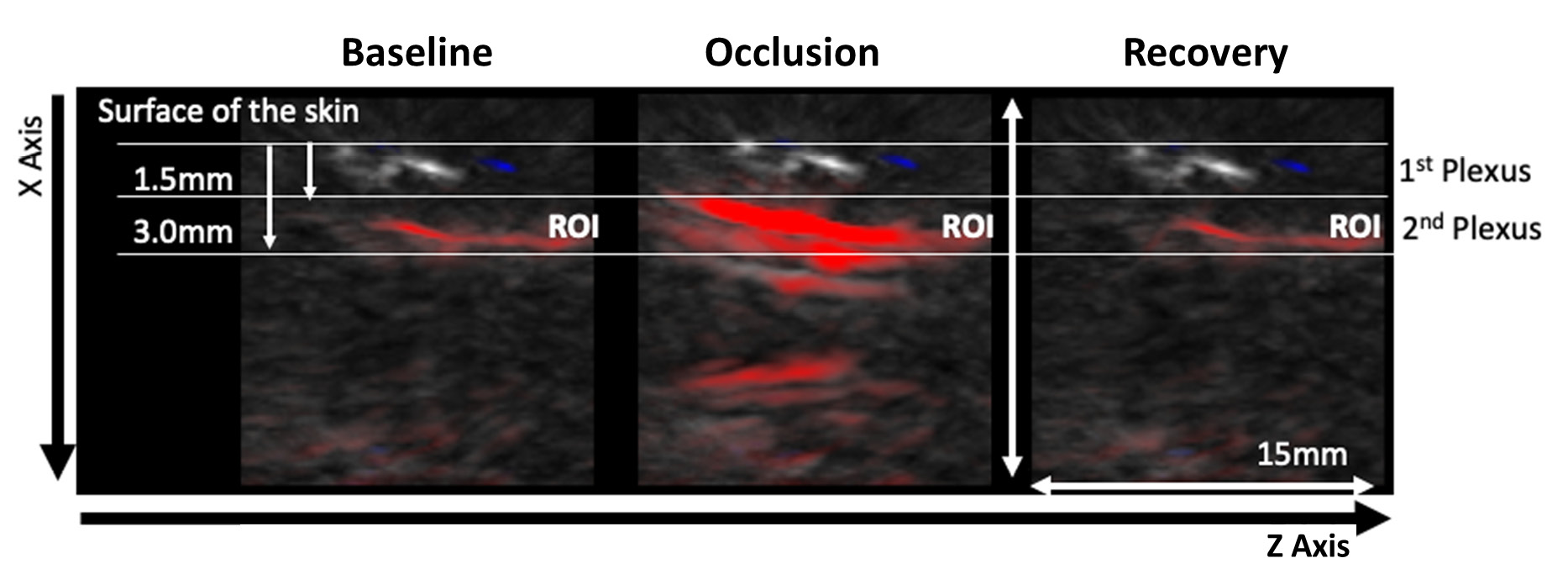 Figure 2 - Representative OAT frames for data acquisition during the PORH protocol.